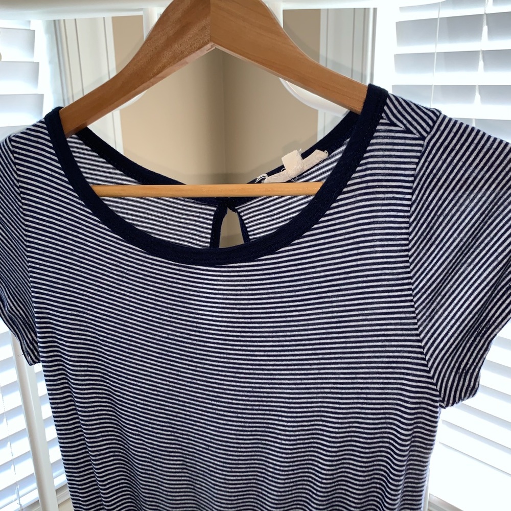 Striped romper - Picture 5 of 7